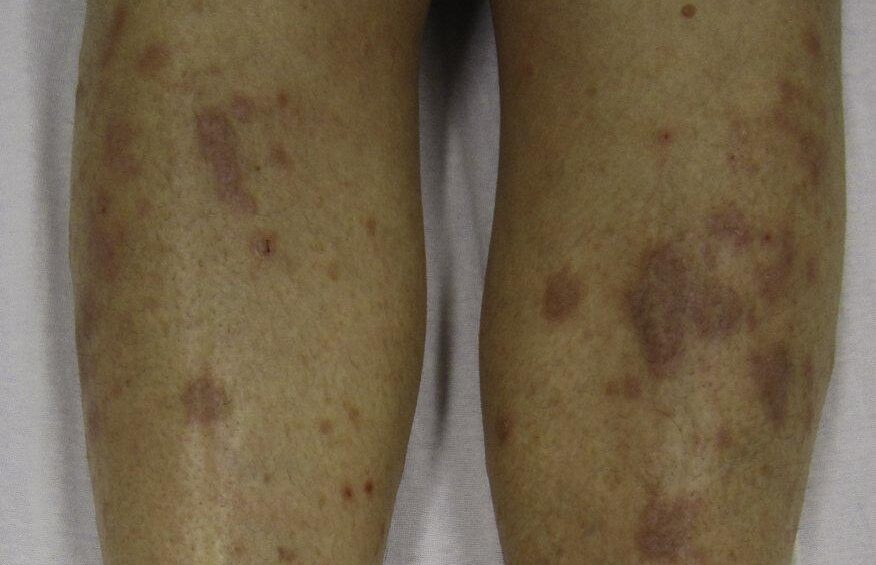 {{brizy_dc_image_alt entityId=