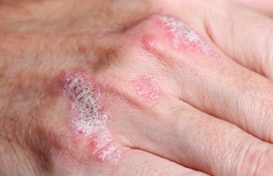 {{brizy_dc_image_alt entityId=