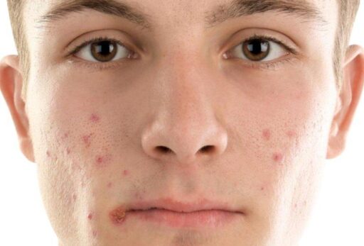 {{brizy_dc_image_alt entityId=