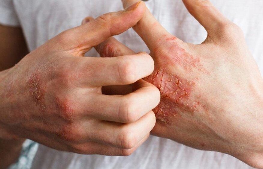 {{brizy_dc_image_alt entityId=