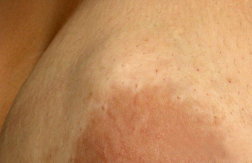 {{brizy_dc_image_alt entityId=