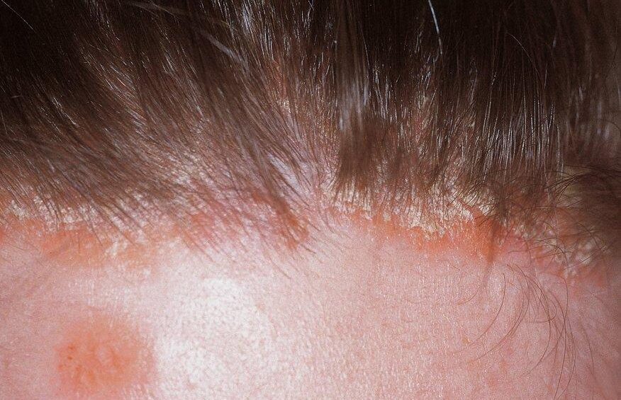 {{brizy_dc_image_alt entityId=