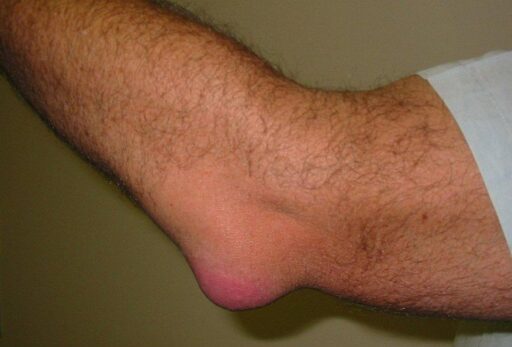 {{brizy_dc_image_alt entityId=