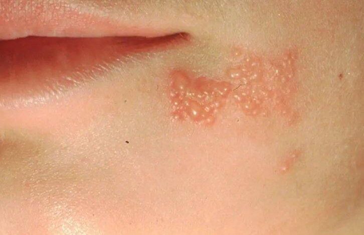 {{brizy_dc_image_alt entityId=