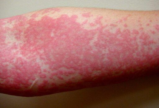 {{brizy_dc_image_alt entityId=