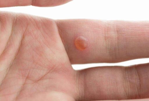 {{brizy_dc_image_alt entityId=